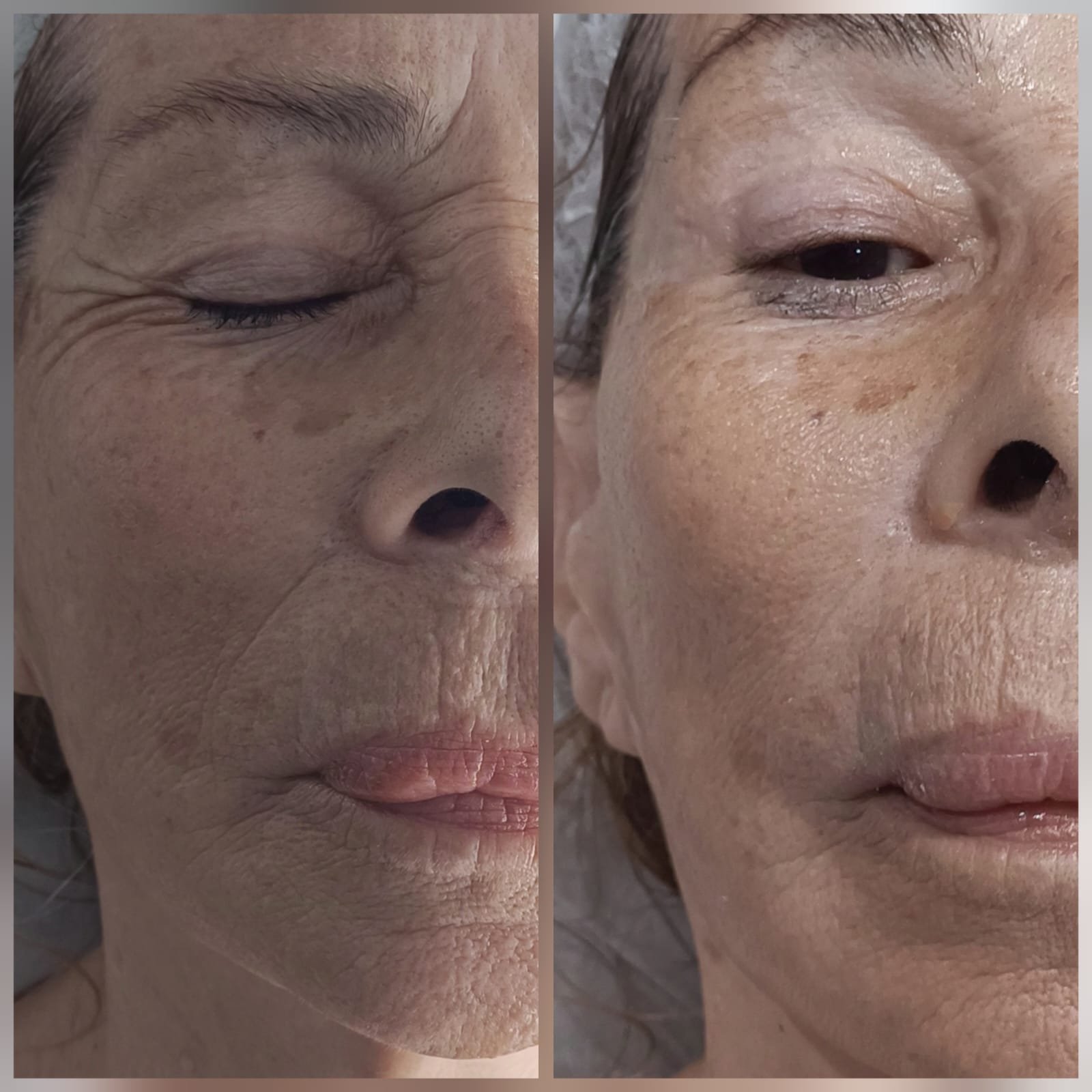 Mascara tensora - Antes e Depois